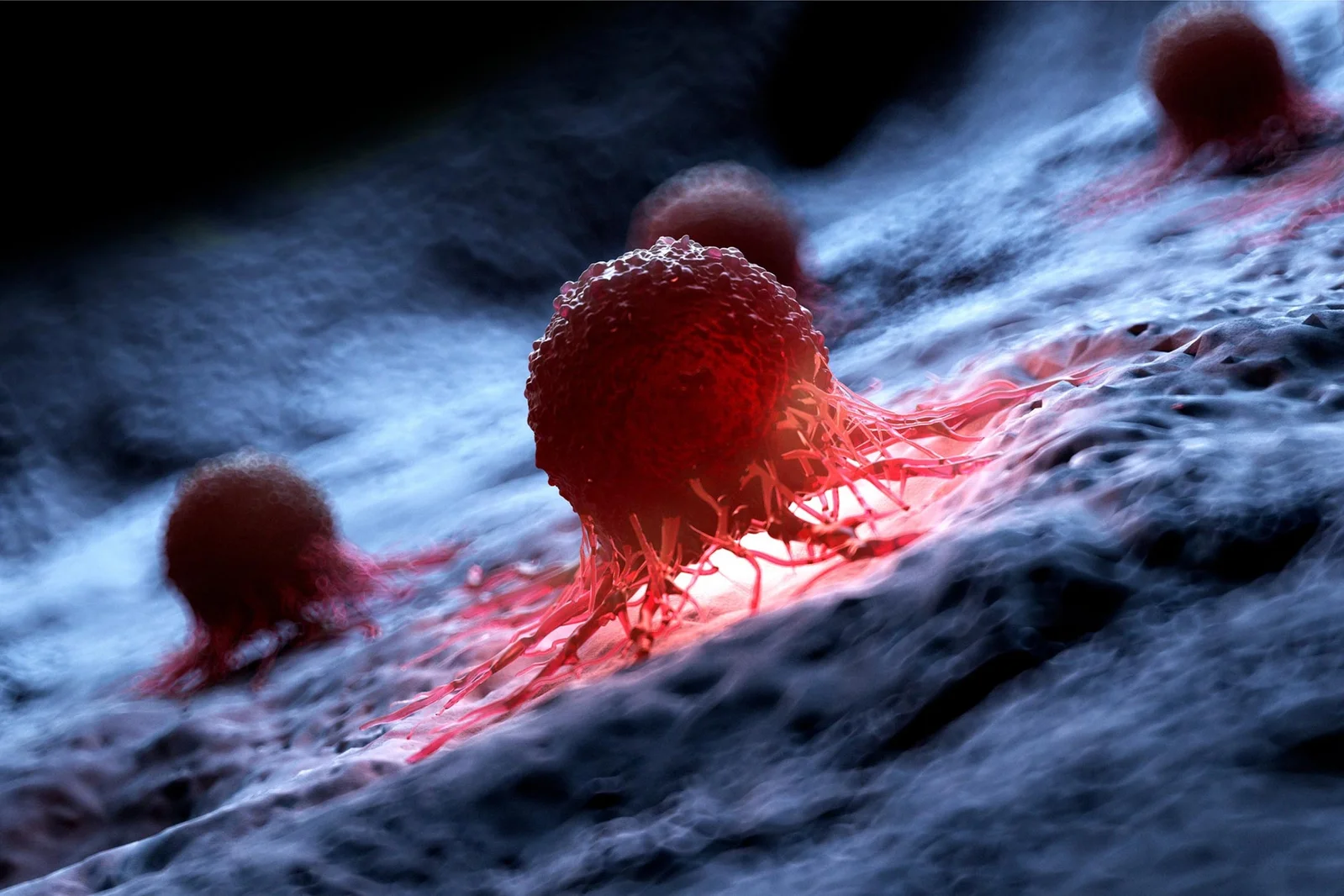 Age Shifts Melanoma Behavior, Prompting Call for Age-Inclusive Cancer Research