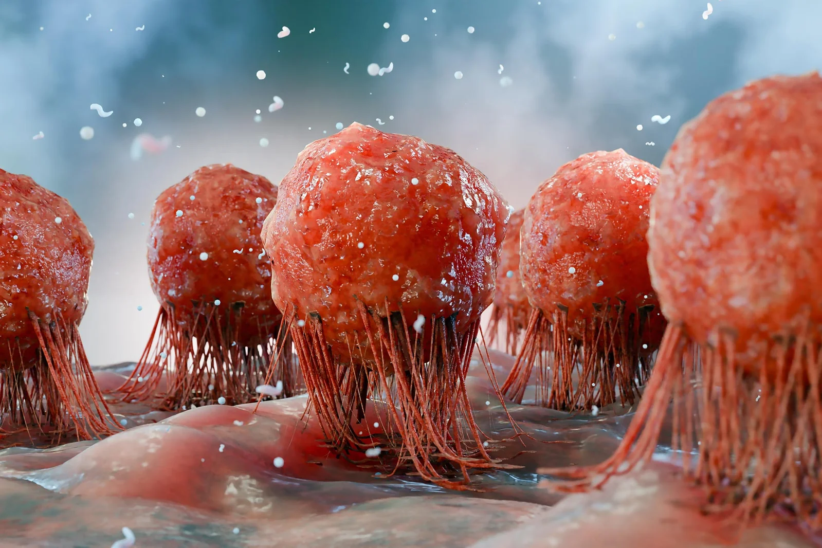 MHC I loss unlocks CD4+ T cell attack via ferroptosis in cancer