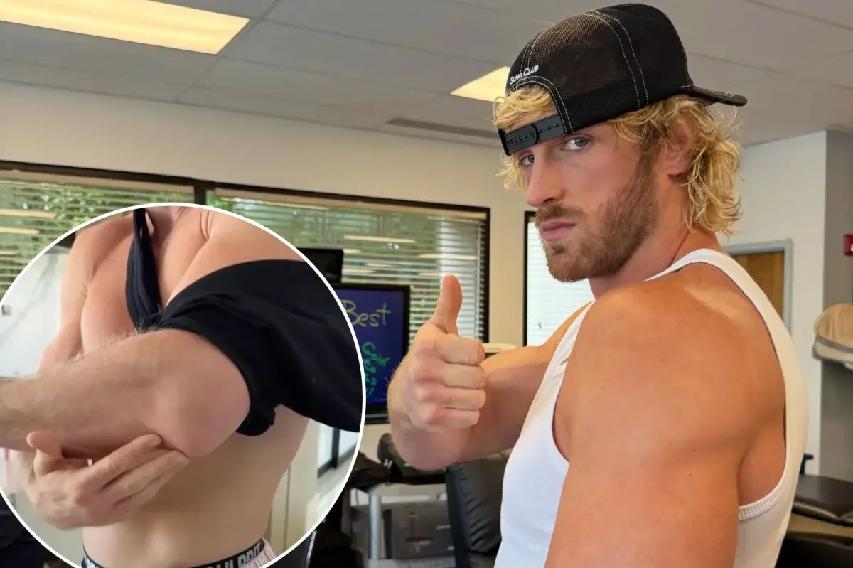 Logan Paul Debuts Gruesome Arm Scar After Triceps Surgery