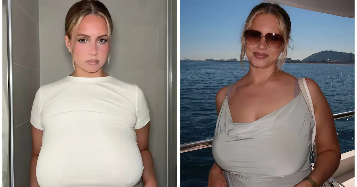 From 36G to 36C: Weight Loss Opens Door to Life-Changing Breast Reduction