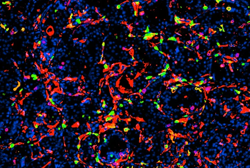 Ultrasmall silica nanoparticles kill prostate tumors and boost antitumor immunity in mice