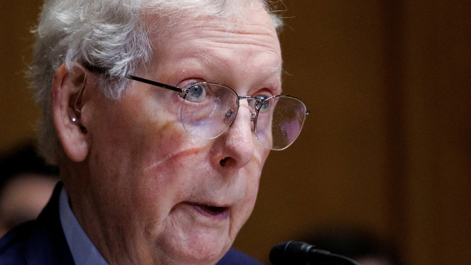 McConnell aide dodges live on-air call amid hospital stay