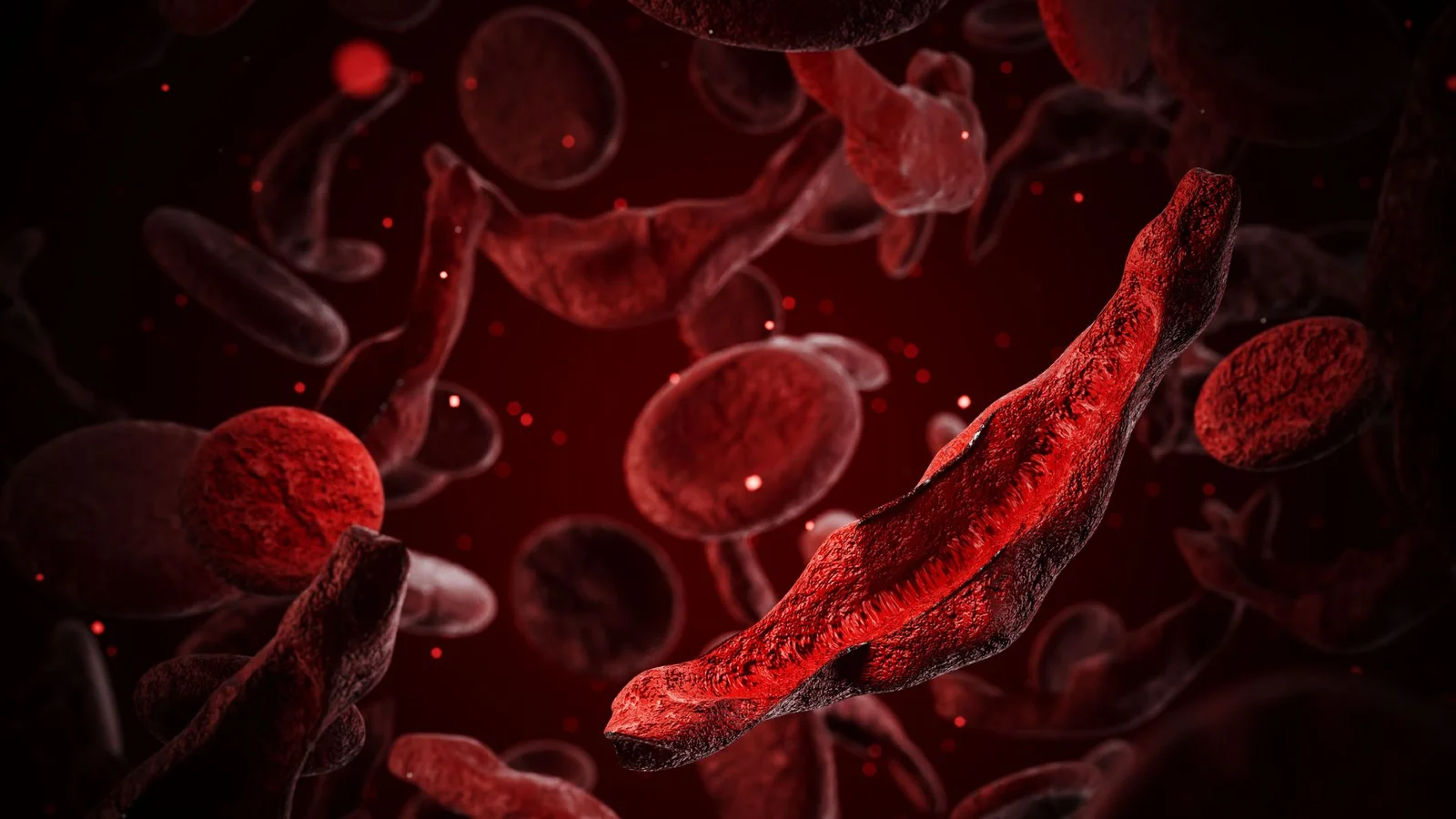 CRISPR-based sickle cell therapy earns $3M Breakthrough Prize for Thein and Orkin