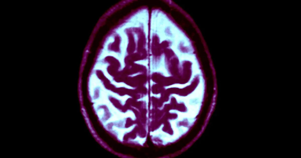 Healthy Midlife Vascular Health Could Delay Dementia by 13 Years