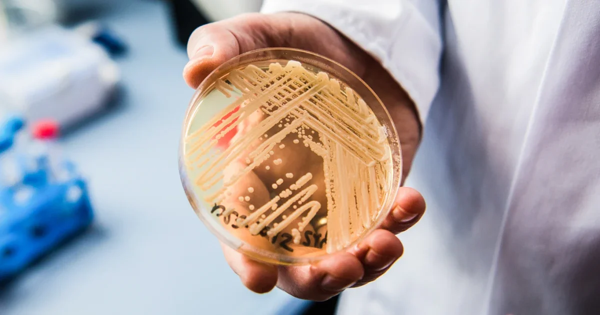 Drug-Resistant Candida auris Surges in U.S. Healthcare Settings