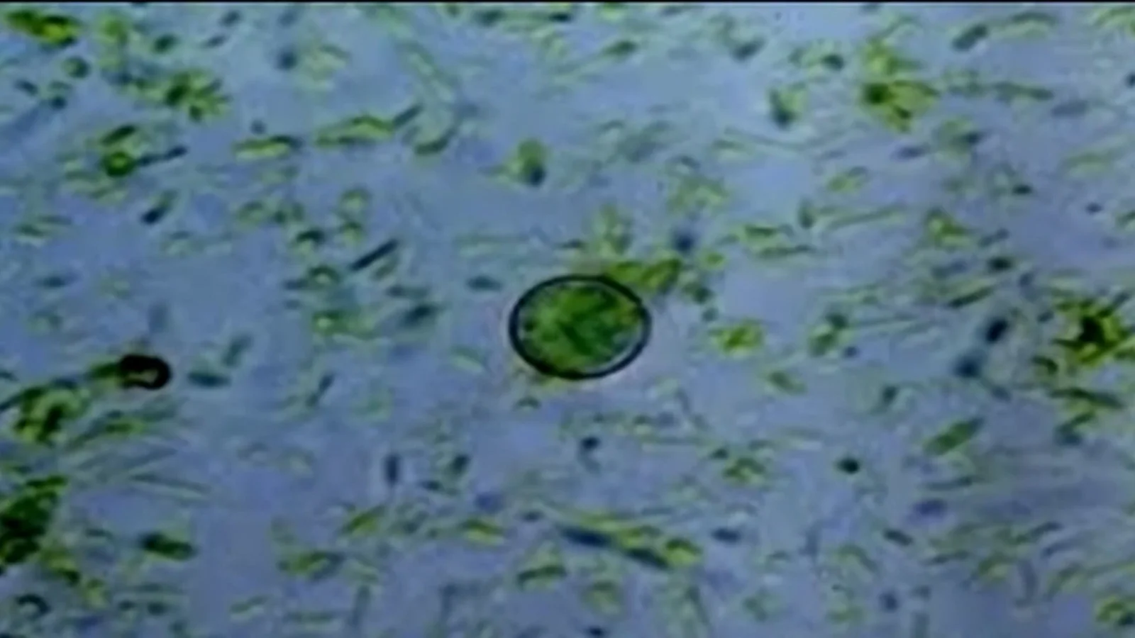 Cyclospora: the hidden parasite behind explosive diarrhea from raw produce