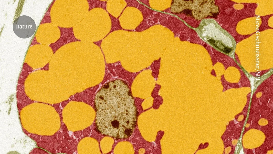 FNIP1 gene variant reshapes body fat and muscle, lowering cardiometabolic risk