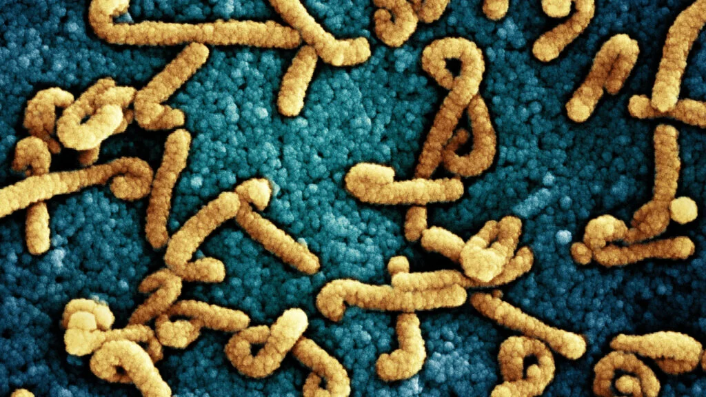 Uganda Faces Potential Marburg Case as Ebola Outbreak Unfolds