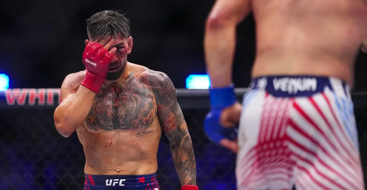Topuria sidelined by orbital fractures after Gaethje upset at UFC White House