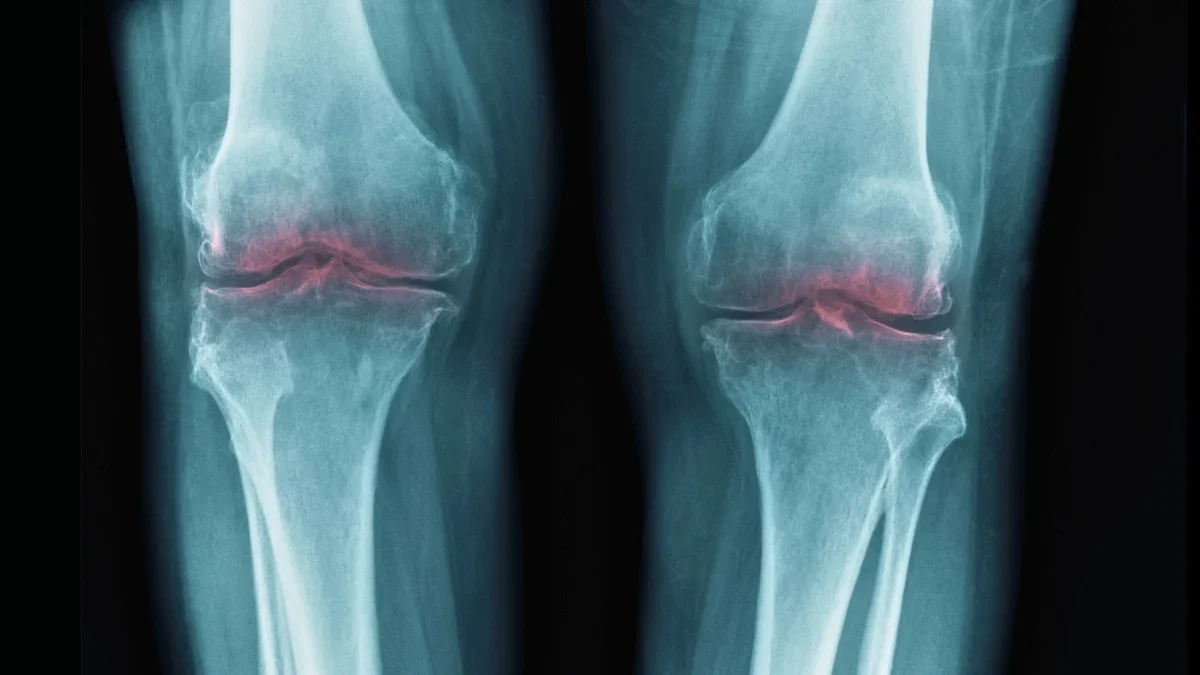 Aging Joint Breakthrough: Blocking 15-PGDH Rebuilds Cartilage