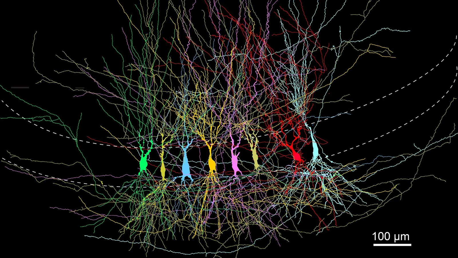 Birth of memory: the brain’s early overconnectivity prunes into precise recall