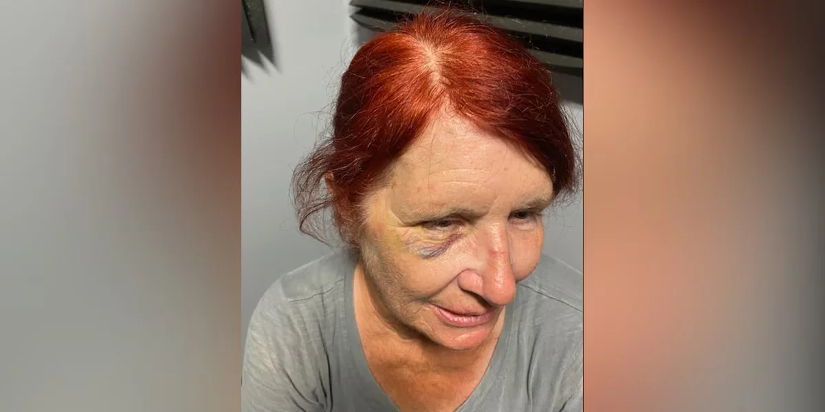 "Resilient Woman Reinstated at Lowe's Following Brave Intervention Against Shoplifting Attack"