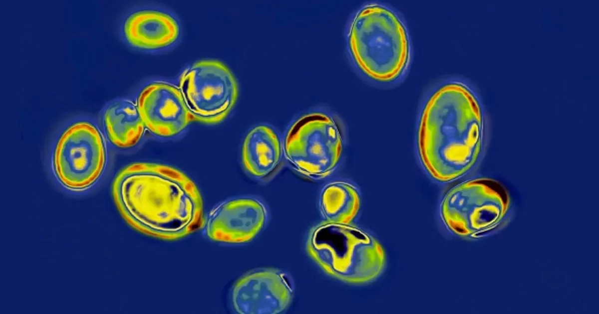 Washington reports 13 cases of hard-to-treat Candida auris in healthcare settings