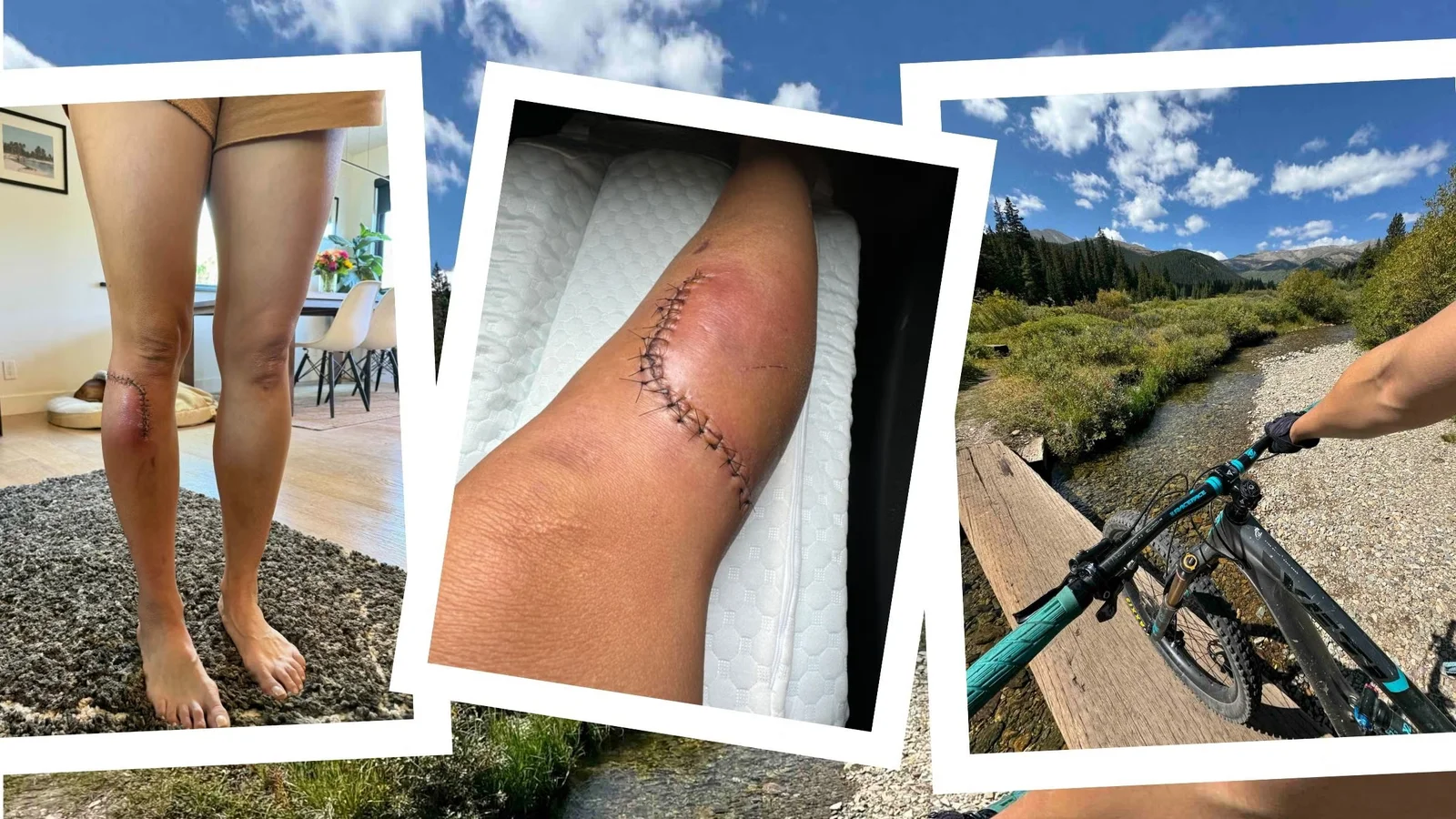 iPhone SOS via Satellite Saved Me After a Solo Mountain Bike Crash