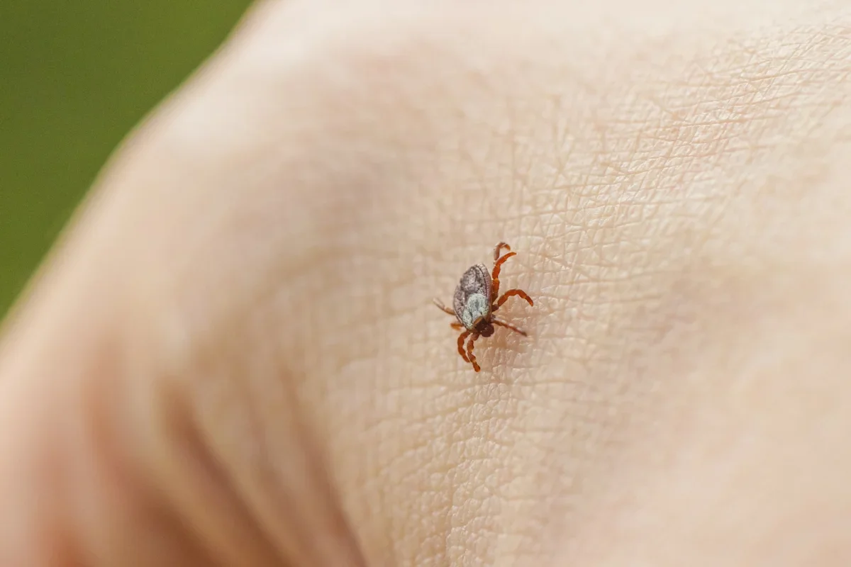 Tick-borne brain inflammation threat expands across the U.S.