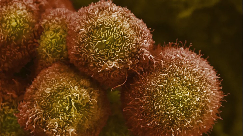 Revolution Medicines' targeted pill delivers striking survival advantage in pancreatic cancer