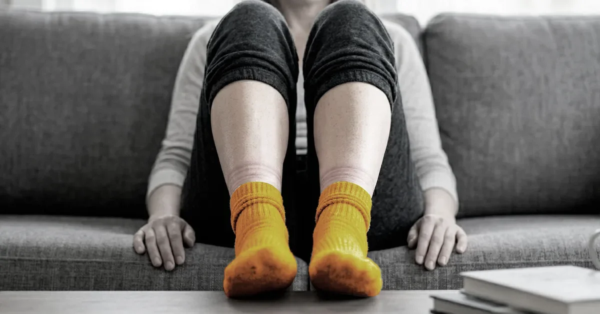 Sock Marks Could Hint at Your Health: When Leg Indents Matter