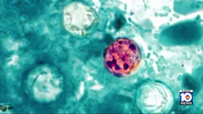 Miami-Dade Tops Florida Cyclospora Counts as Lettuce Recall Ties Into Outbreak