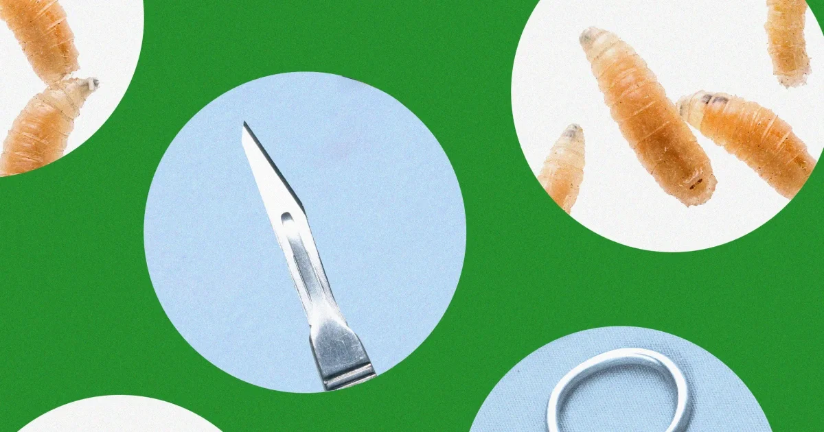 Tiny maggots, big healing: maggot therapy in modern wound care