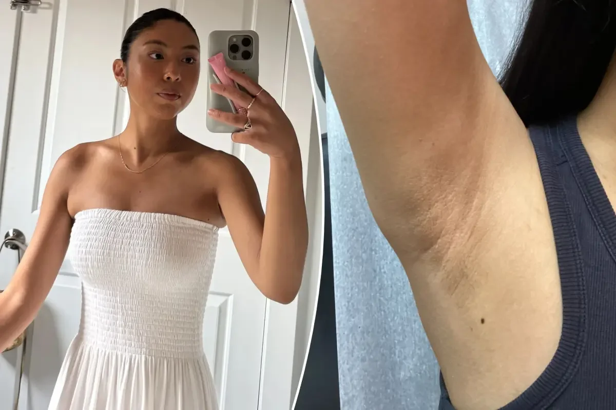 Shaving Mistakes That Trigger Underarm Dermatitis—and How to Fix Them