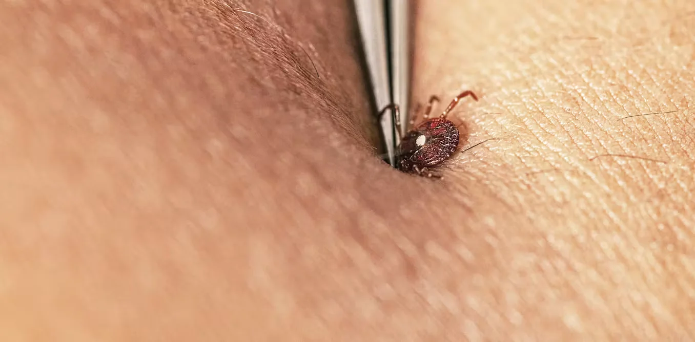 Keep ticks at bay: practical ways to prevent bites in your yard and on trails