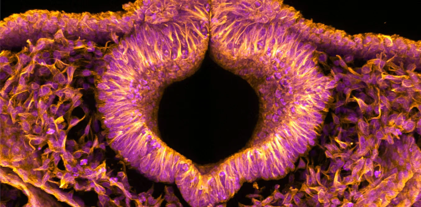 Glowing Quail Embryos Reveal How Neural Tubes Form