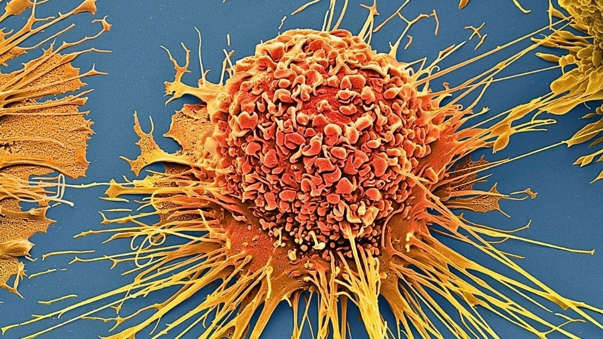 Light-Activated Molecular Jackhammers Physically Tear Cancer Cells in Lab