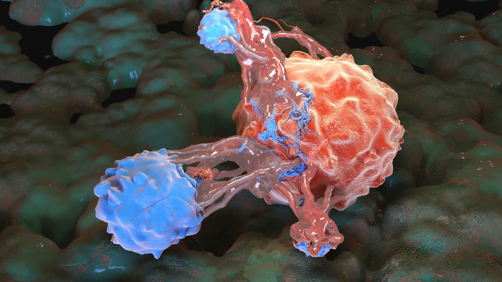 RAS-targeting drug daraxonrasib nearly doubles median survival in pancreatic cancer trial