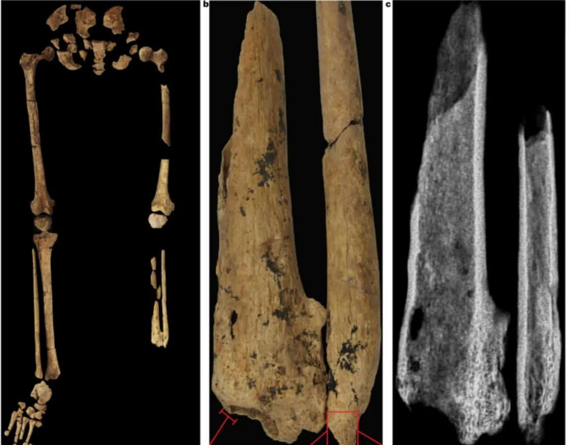 30,000-Year-Old Surgery Evidence Reframes Human History