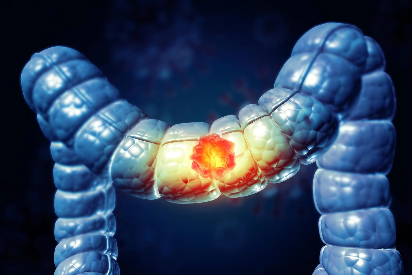 Claudin-4 Receptor Unmasks How Gut Bacteria Trigger Colorectal Cancer