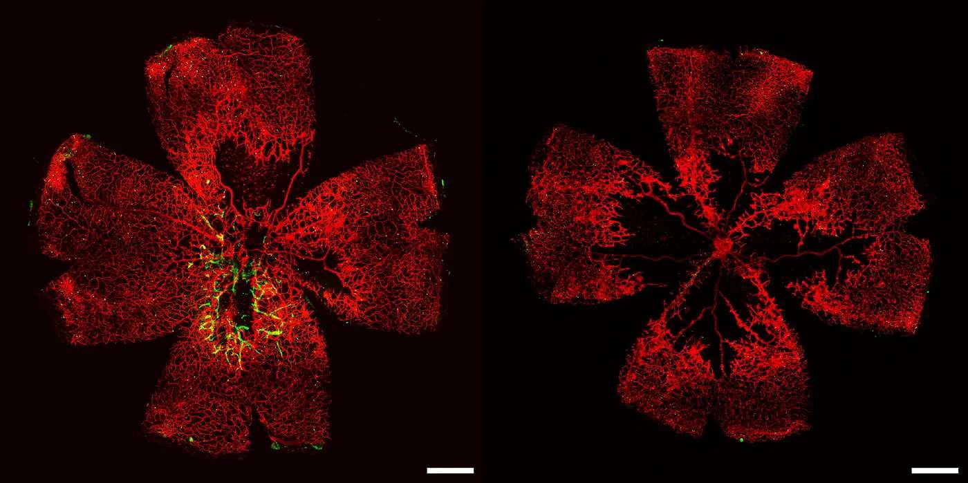 Lab-grown retinal vessels restore function in mice, fueling hope for blindness treatments