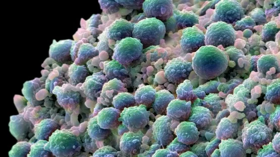 Ultrasmall silica nanoparticles kill prostate cancer cells and awaken antitumor immunity