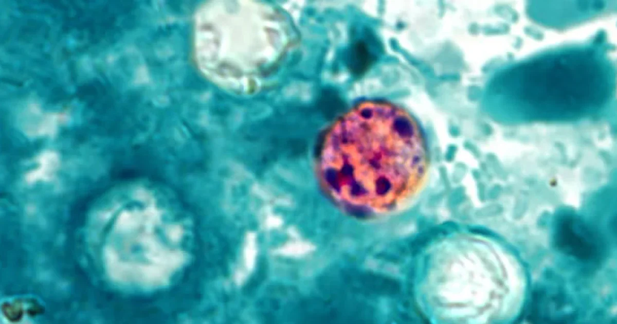 Lettuce Under Scrutiny in US Cyclospora Outbreak, Michigan Officials Say