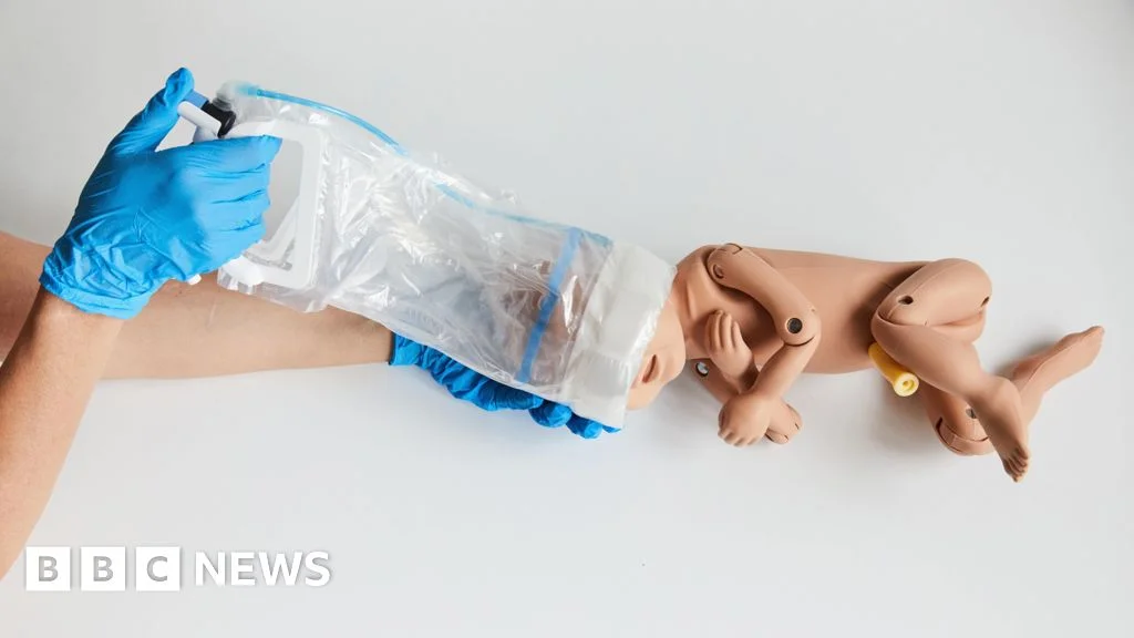 Calm Birth Breakthrough: OdonAssist Debuts at Southmead Hospital