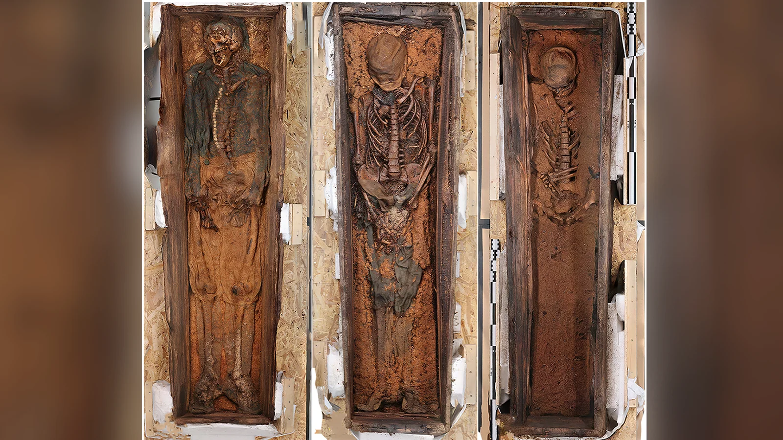 Arctic whalemen's bones reveal brutal life and scurvy at Corpse Point