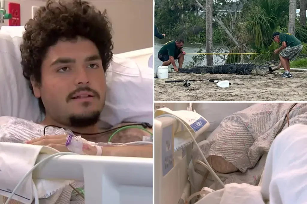 Florida Man Survives Alligator Attack, Loses Arm