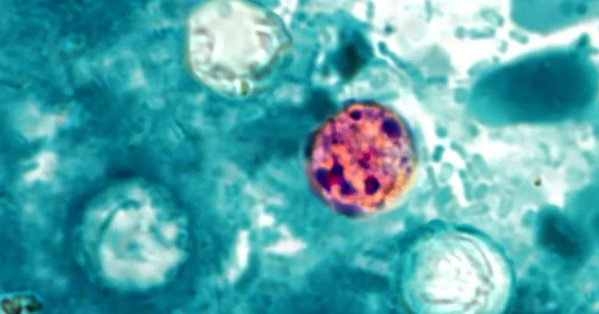 Cyclosporiasis cases approach 7,000 nationwide as investigations widen