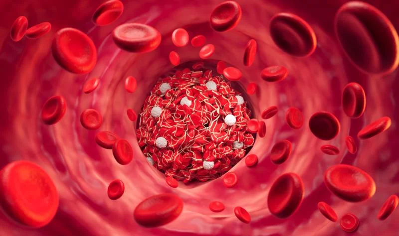 COVID-19 viremia linked to deadly clots in new study