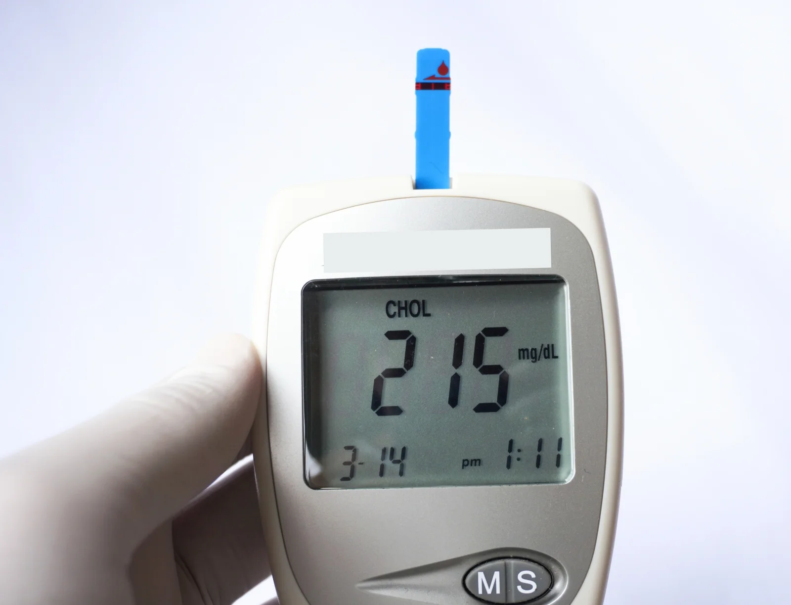 Novel DL-1 compound slashes LDL cholesterol without fatty liver
