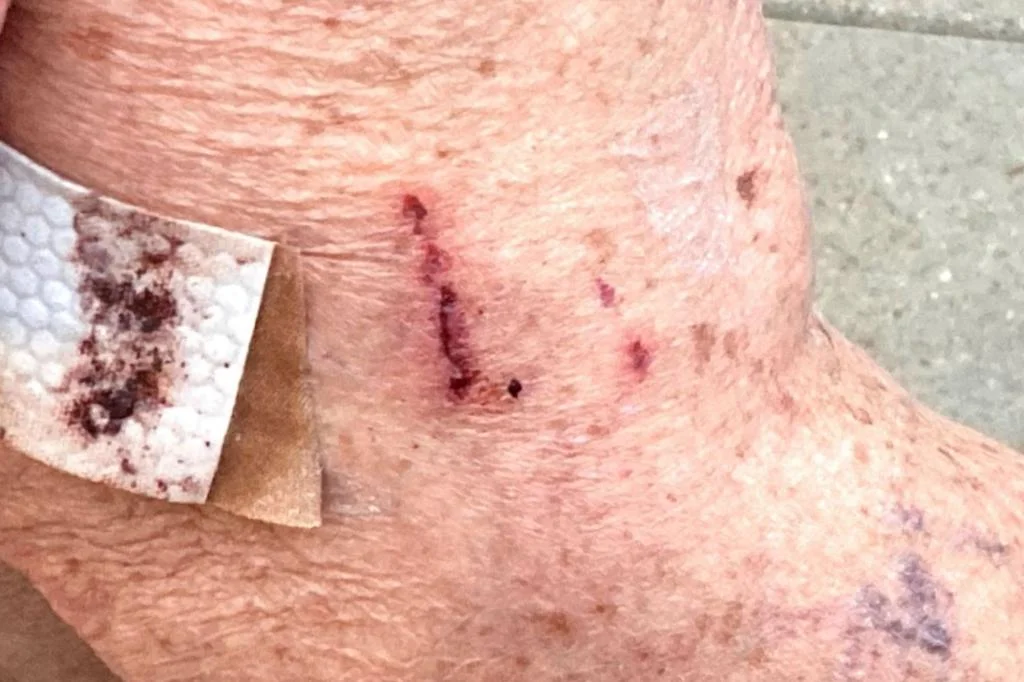 "Bear Breaks into Colorado Woman's Home, Injures Elderly Resident"