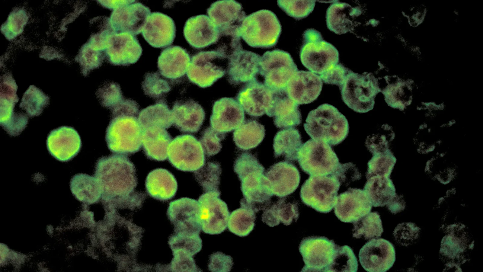 NC teen’s brain-eating amoeba death linked to community center water feature