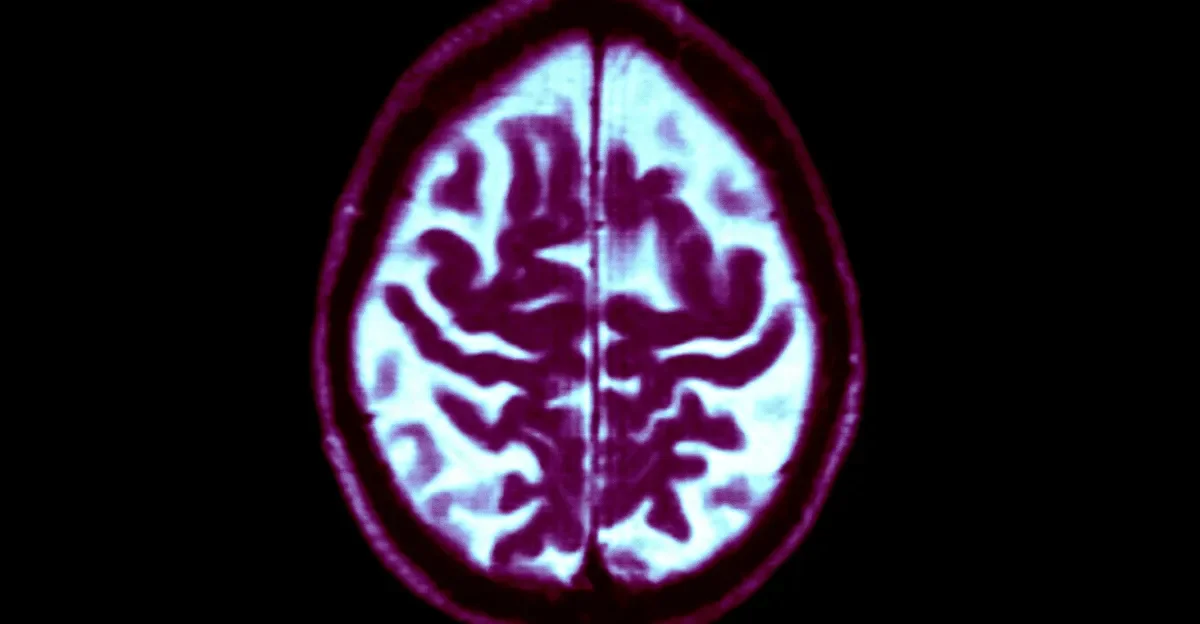 Midlife habits lower dementia risk even as total cases rise