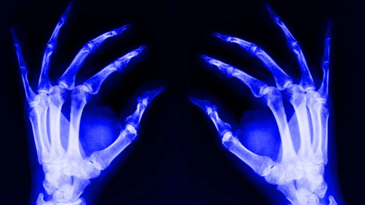 Aging Blood Stem Cells May Spark Inflammation Across the Body