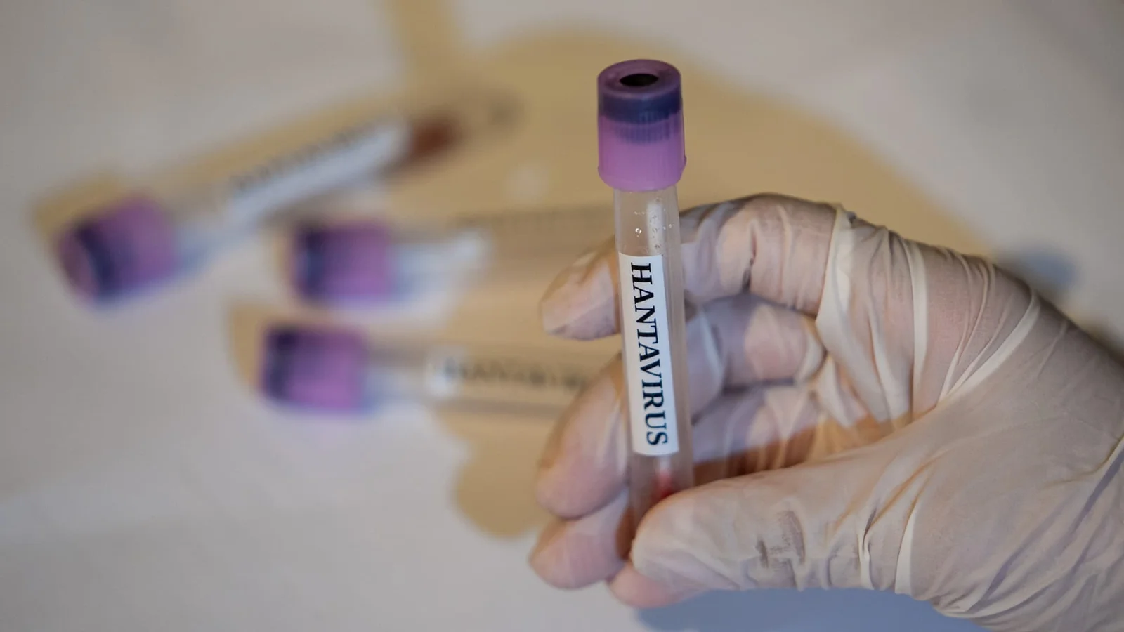 CDC: No current U.S. hantavirus cases, 41 people under monitoring amid cruise-ship outbreak
