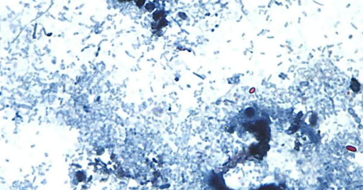 Michigan Cyclospora Outbreak Surges to 572 Cases