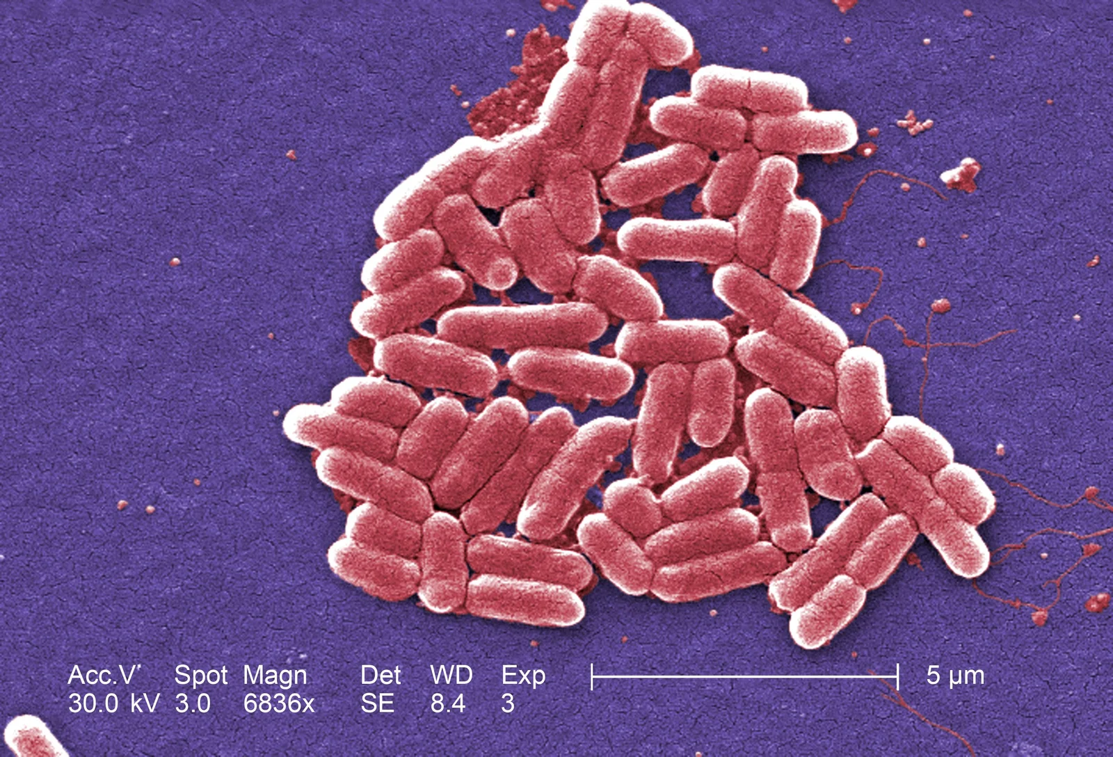 San Diego County Confirms Two Local E. coli Cases Linked to Kebab Shop Outbreak