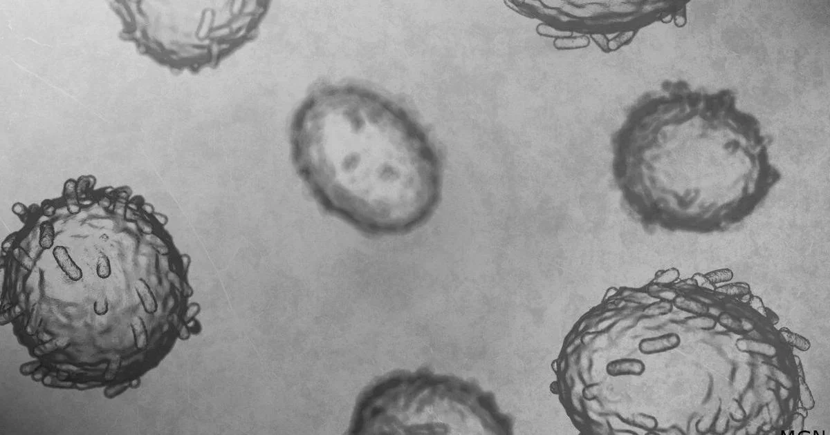 Wisconsin reports five mpox cases, with cluster in the southeast