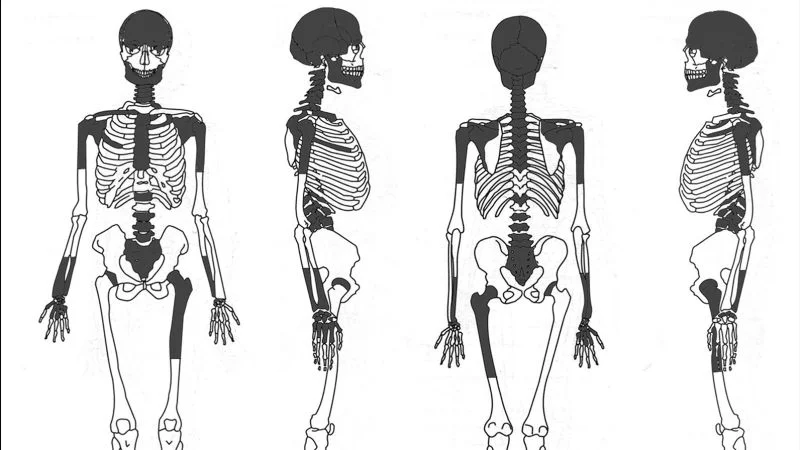 Brain-removal ritual linked to Iron Age Scottish burial, study finds