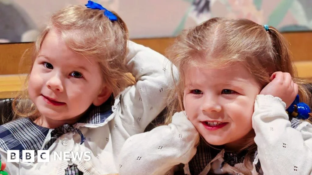Non-invasive ultrasound treatment stabilizes TTTS in twin pregnancies
