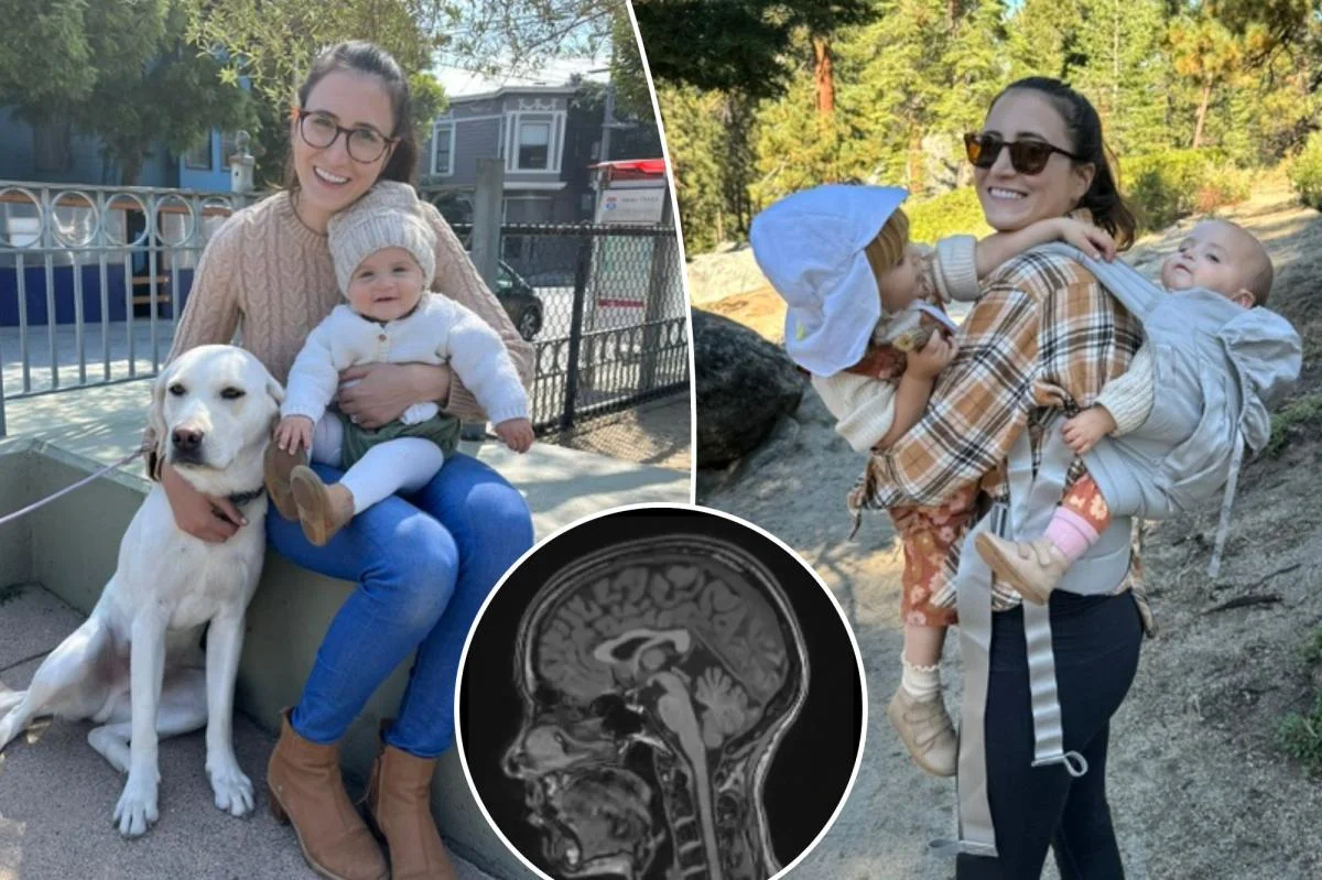 Decade-long misdiagnosis uncovers a slow-growing brain tumor